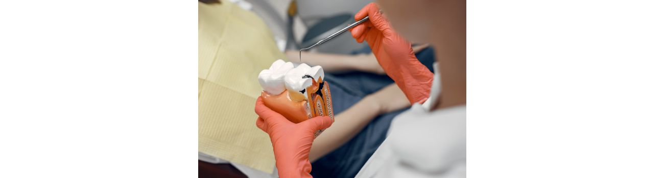 Ile kosztuje leczenie kanałowe zęba i co rzeczywiście wpływa na jego cenę?