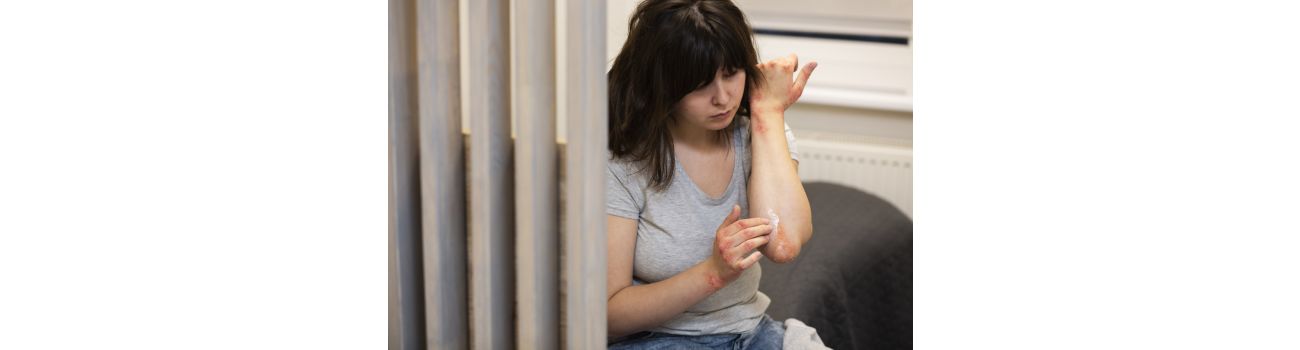 Łuszczyca bywa tabu. Czym jest, skąd się bierze i jak ją leczyć?