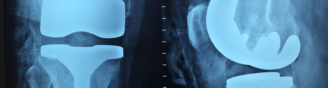 Oddziały Pomocy Doraźnej to nowość LUX MED. Jak i gdzie działają te placówki?