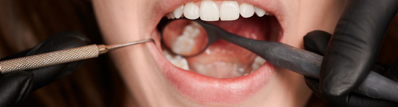 Co to jest leczenie kanałowe i ile kosztuje taki zabieg stomatologiczny?