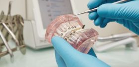 Leczenie zgryzu u dzieci a błędy. Na co zwrócić uwagę rozpoczynając korekcję?