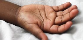 Dlaczego skóra jest sucha? Powód to nie tylko genetyka