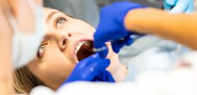 Scaling bez tajemnic. Na czym polega ten zabieg u stomatologa i dlaczego jest ważniejszy, niż się wydaje